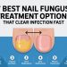 7 Best Nail Fungus Treatment Options That Clear Infection Fast