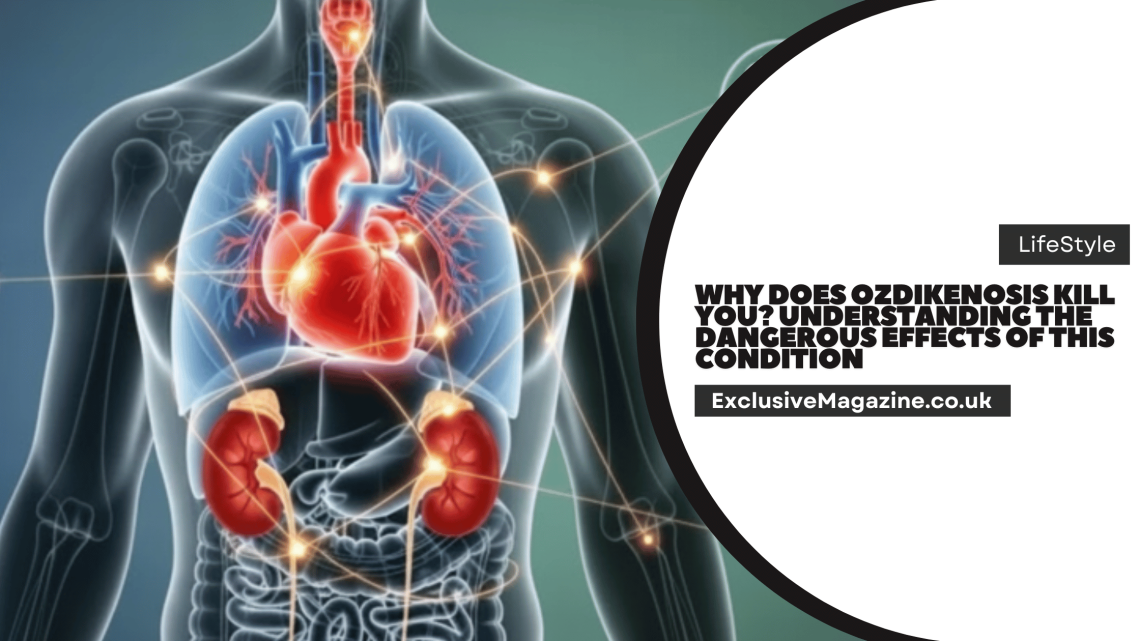 Why Does Ozdikenosis Kill You?