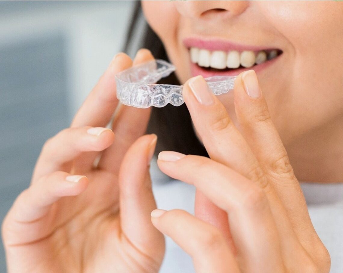 How Many Aligners Will You Need for Your Invisalign Middlesbrough Treatment