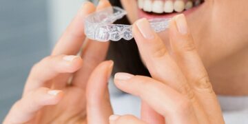 How Many Aligners Will You Need for Your Invisalign Middlesbrough Treatment