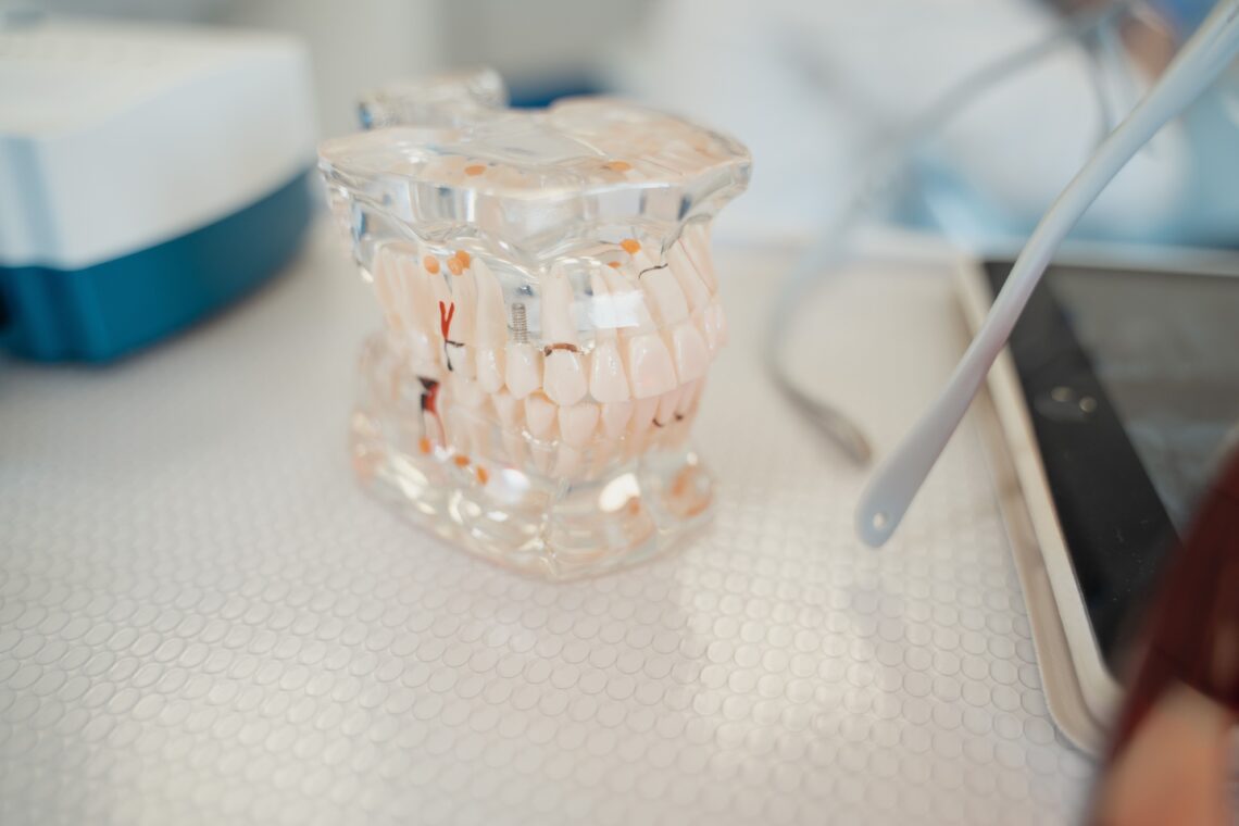 The Role of Dental Implants in Smile Function and Aesthetics