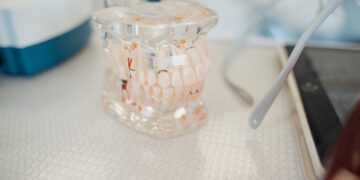 The Role of Dental Implants in Smile Function and Aesthetics